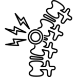 Bulging Disc Treatment